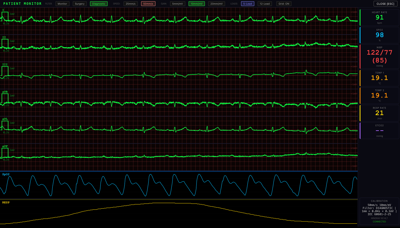 RNS Patient Monitor: full 5-lead diagnostic ECG with leads I, II, III, aVR, aVL, aVF, SpO2 waveform, blood pressure, temperature and respiration curves